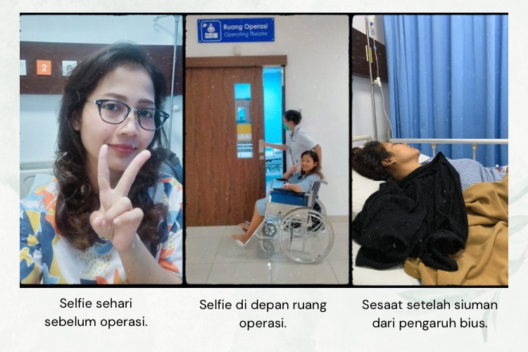 Mengenal Kista Ganglion